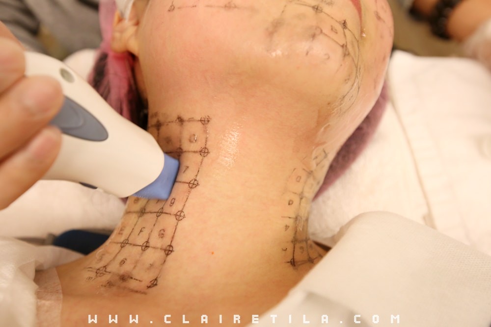 20251024-ar0zu 20251024-ar0zu