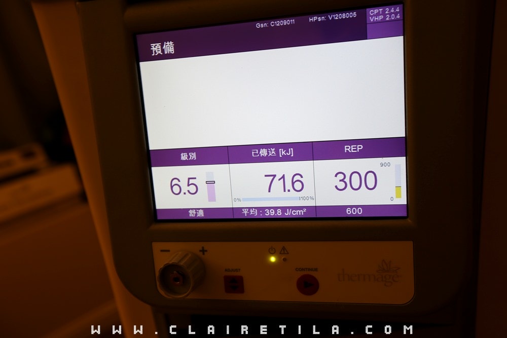 20251024-bcxlb 20251024-bcxlb