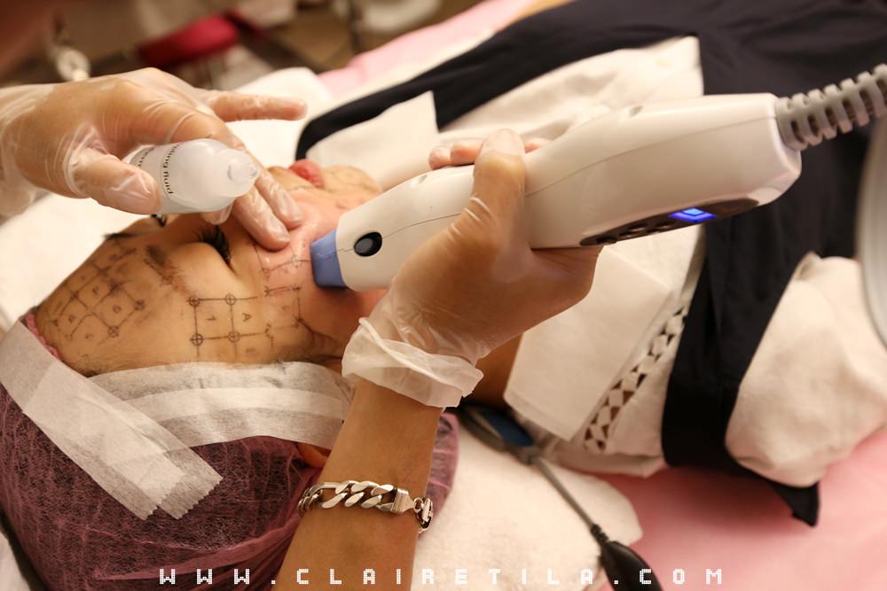 20251024-j4lti 20251024-j4lti